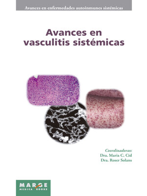 cover image of Avances en vasculitis sistémicas